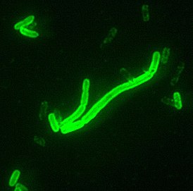 Yersinia pestis под флуоресцентным микроскопом. Источник: Википедия.
